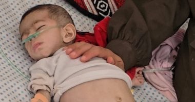 وفاة طفلة من غزة نتيجة المجاعة ترفع عدد الضحايا إلى 54 طفلًا 2 وفاة طفلة من غزة نتيجة المجاعة ترفع عدد الضحايا إلى 54 طفلًا