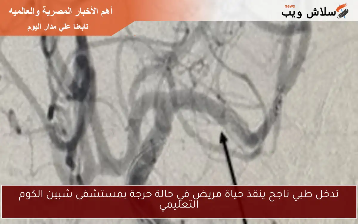 تدخل طبي ناجح ينقذ حياة مريض في حالة حرجة بمستشفى شبين الكوم التعليمي 2 تدخل طبي ناجح ينقذ حياة مريض في حالة حرجة بمستشفى شبين الكوم التعليمي