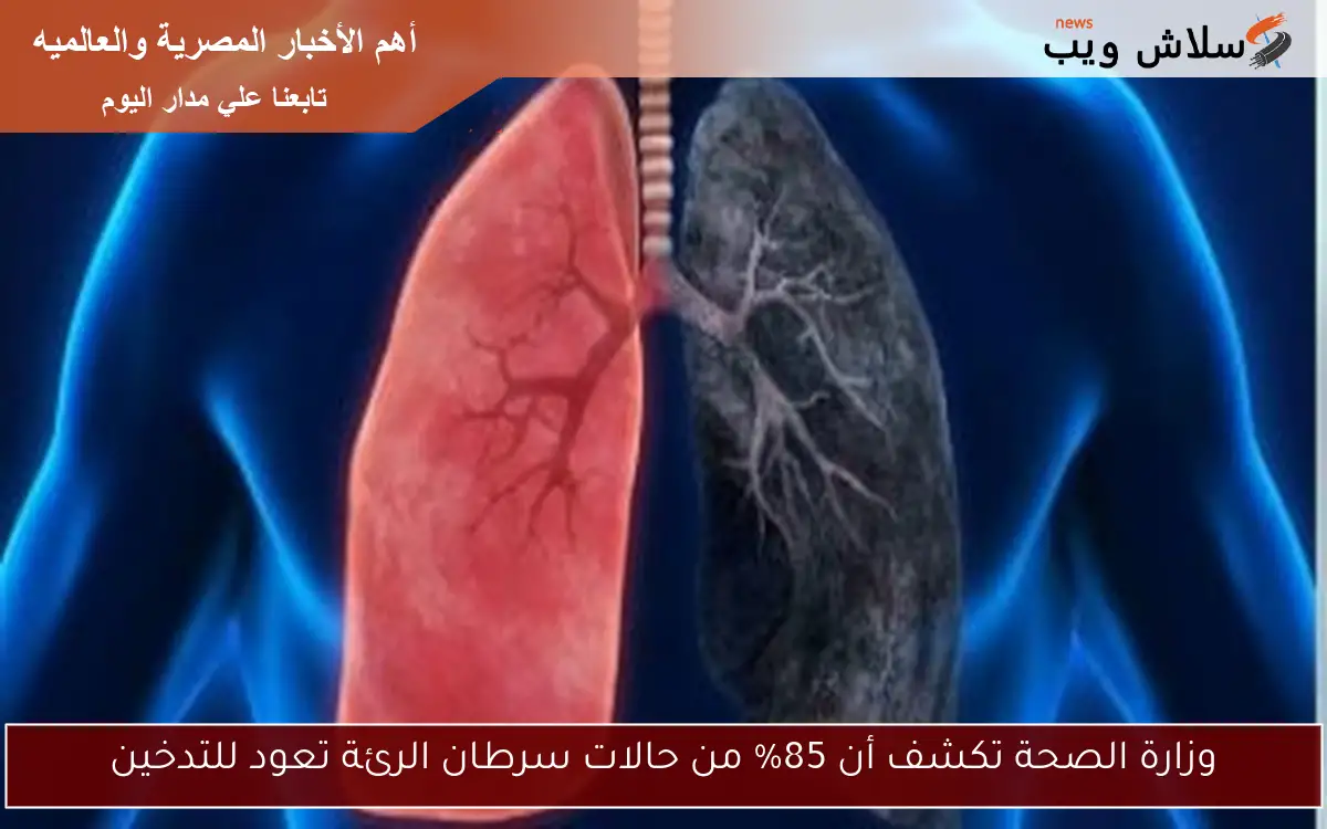وزارة الصحة تكشف أن 85% من حالات سرطان الرئة تعود للتدخين 2 وزارة الصحة تكشف أن 85% من حالات سرطان الرئة تعود للتدخين