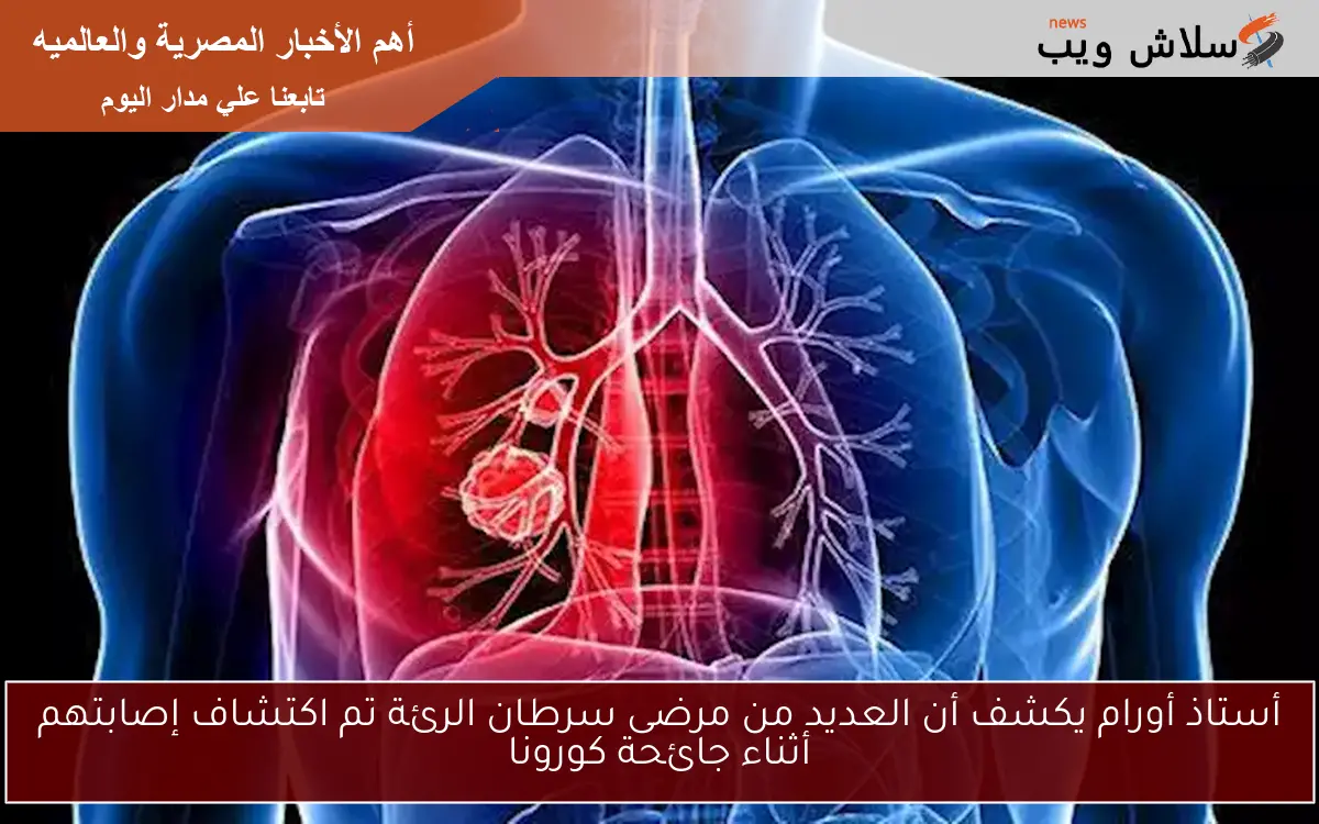 أستاذ أورام يكشف أن العديد من مرضى سرطان الرئة تم اكتشاف إصابتهم أثناء جائحة كورونا