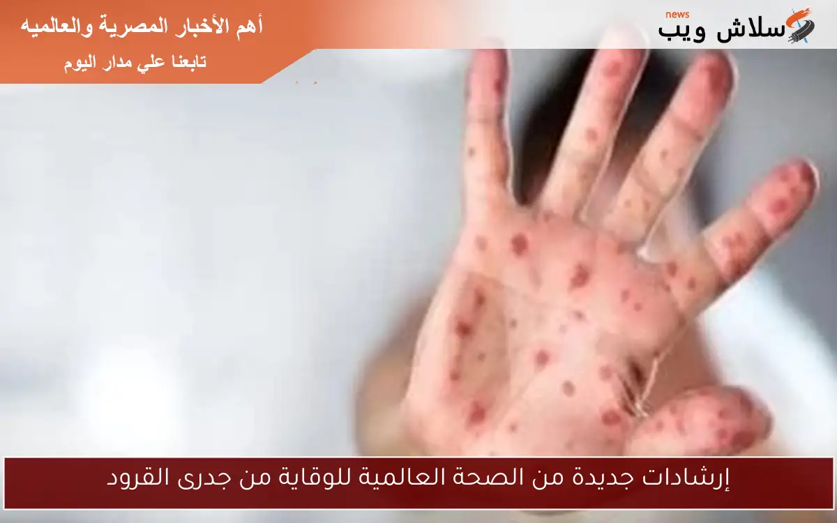 إرشادات جديدة من الصحة العالمية للوقاية من جدرى القرود 2 إرشادات جديدة من الصحة العالمية للوقاية من جدرى القرود