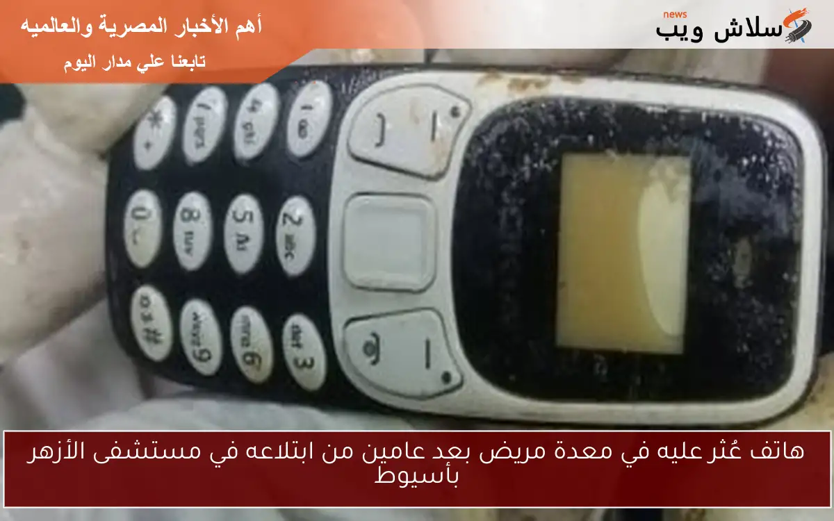 هاتف عُثر عليه في معدة مريض بعد عامين من ابتلاعه في مستشفى الأزهر بأسيوط 2 هاتف عُثر عليه في معدة مريض بعد عامين من ابتلاعه في مستشفى الأزهر بأسيوط