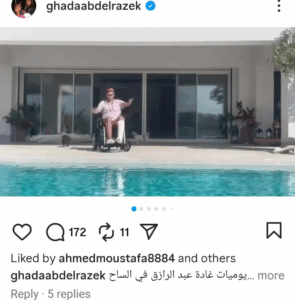 بعد إصابتها بكسر في ساقها: آخر اخبار الحالة الصحية للفنانة غادة عبد الرازق 3 الحالة الصحية للفنانة غادة عبد الرازق